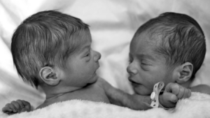 Accouchement de jumeaux à domicile : un choix rare mais possible
