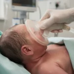 Ventouse lors de l'accouchement